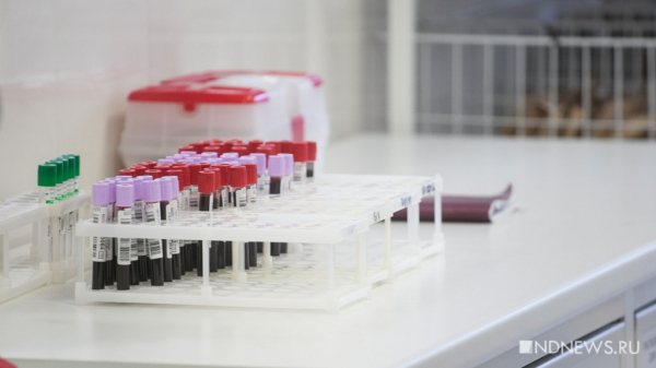 В ЕС более половины диагнозов ВИЧ ставятся слишком поздно В ЕС более половины диагнозов ВИЧ ставятся слишком поздно